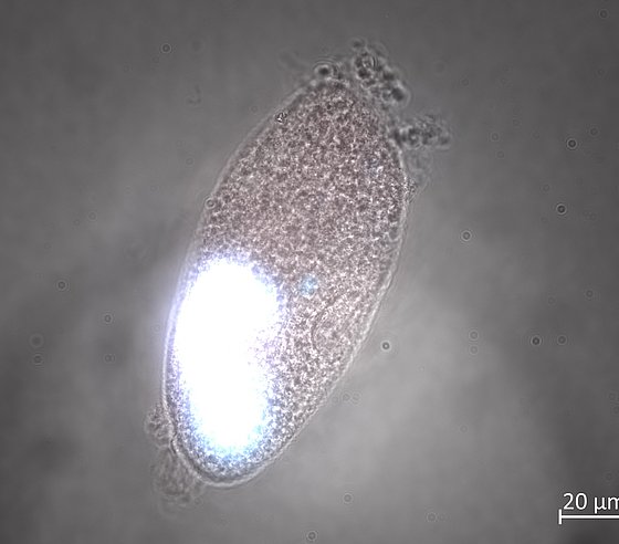 Mikroskopische Aufnahme eines Pantoffeltierchens, das zum Teil durch Fluoreszenzfarbstoff zum Leuchten gebracht wird.